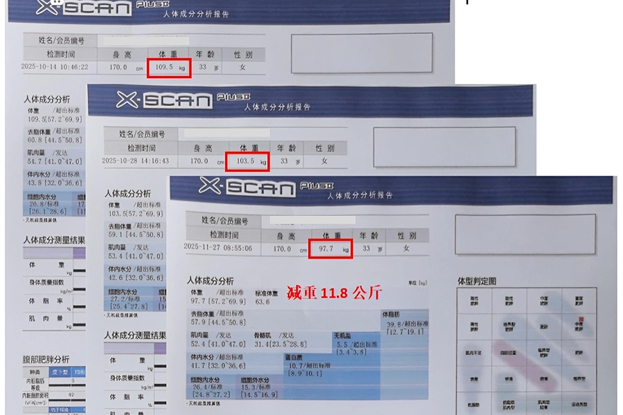 不饿肚子、不伤关节！她2个月减20斤：在青岛市妇女儿童医院，减重终于成了件“可持续” 的小事