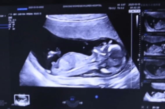 医刻｜走进超声医学专家门诊，了解胎儿NT增厚