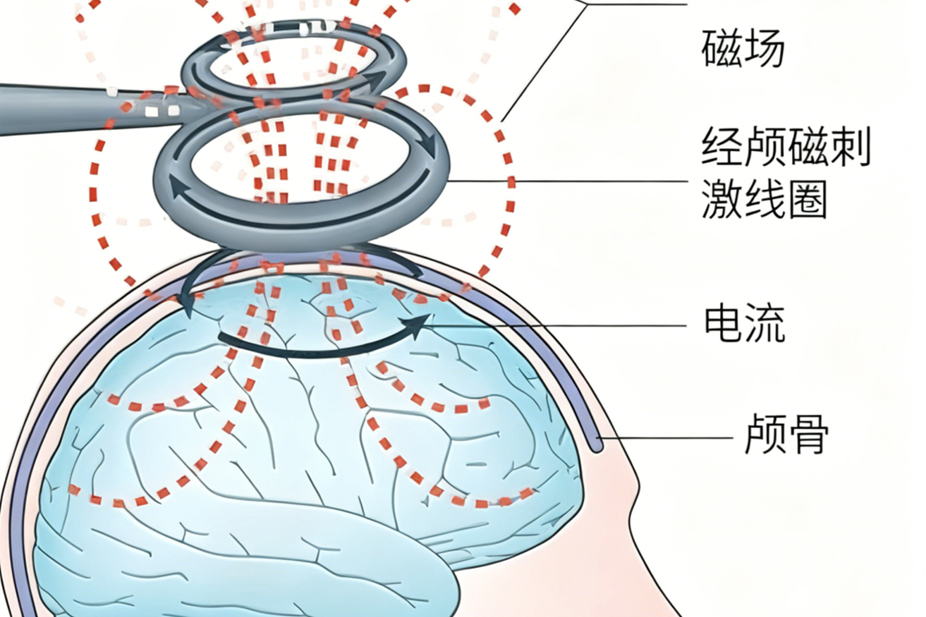 孩子上课老是走神、坐不住，是病吗？给大脑“充电”后，“老实”多了
