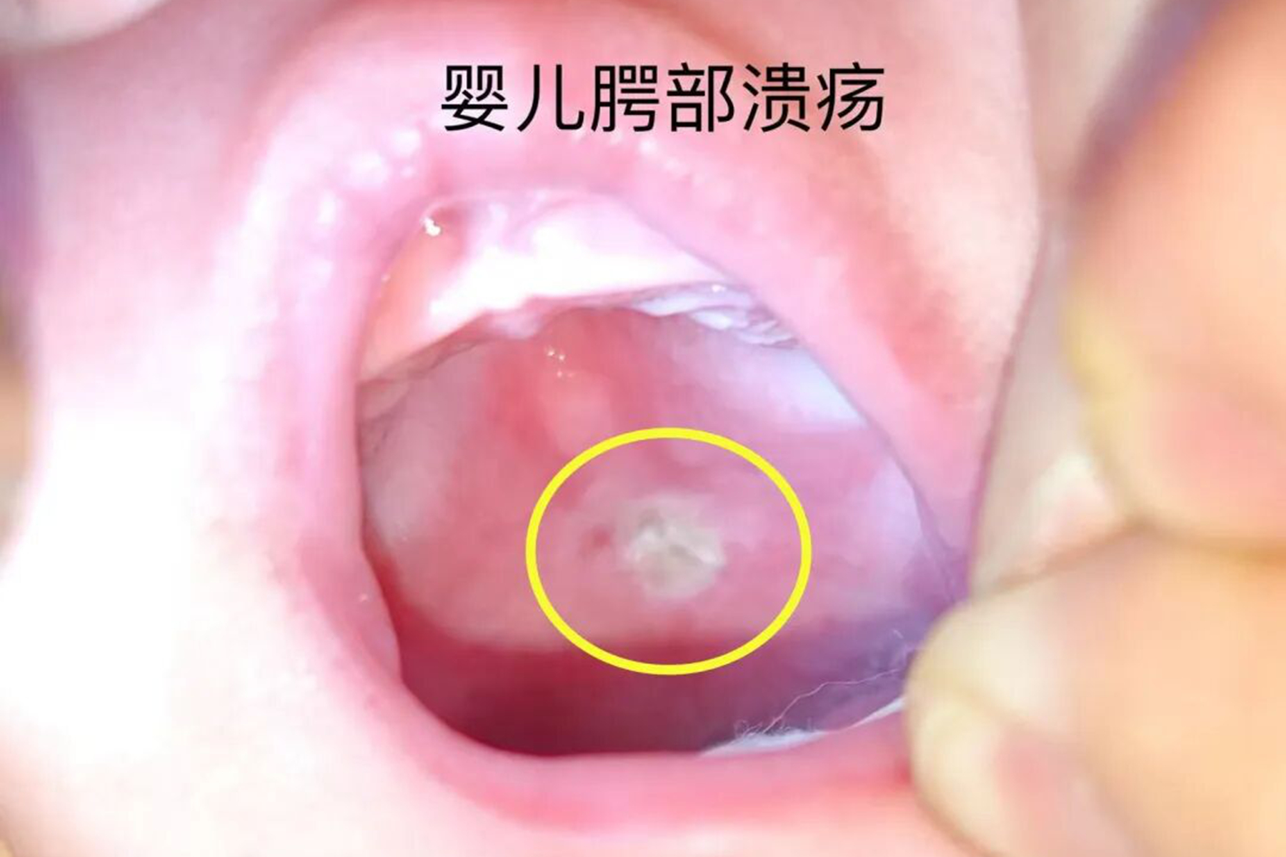 万万没想到!宝宝拒奶哭闹,问题竟出在奶嘴上,家有奶娃速查